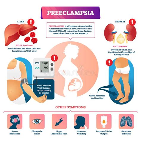 Diagramma sintomi preeclampsia