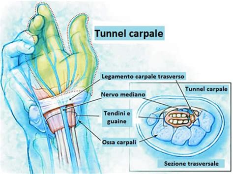 Anatomia mano sindrome tunnel carpale