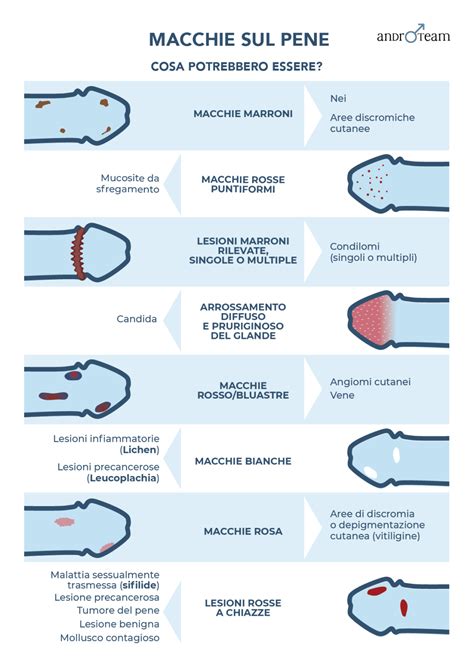 Illustrazione di un uomo che ritira il pene dalla vagina prima dell'eiaculazione