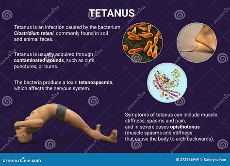 Illustrazione stilizzata di una ferita contaminata da spore di tetano