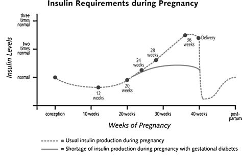 Schematic insulin resistance in pregnancy
