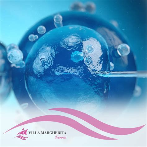 Infografica: Fattori che influenzano il successo della PMA