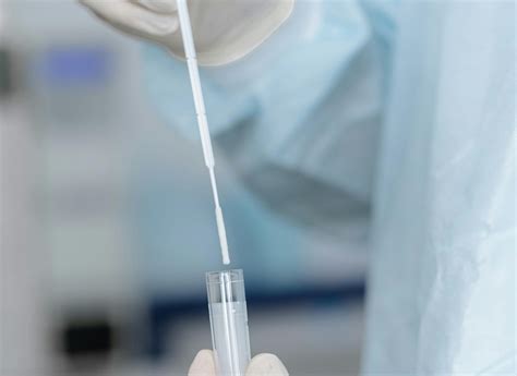 Microrganismi rilevati dal tampone vaginale