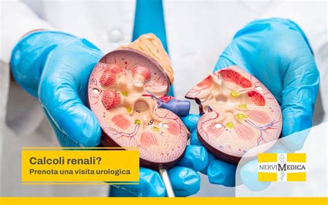 Infografica sulle opzioni terapeutiche per i calcoli renali (MET, Chemiolisi, Chirurgia)