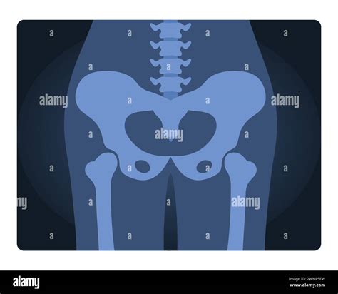 Diagramma comparativo della pelvi umana e scimmia