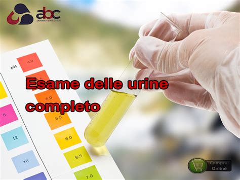 rappresentazione grafica di un esame completo delle urine in laboratorio