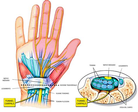 rappresentazione anatomica della mano e del tunnel carpale