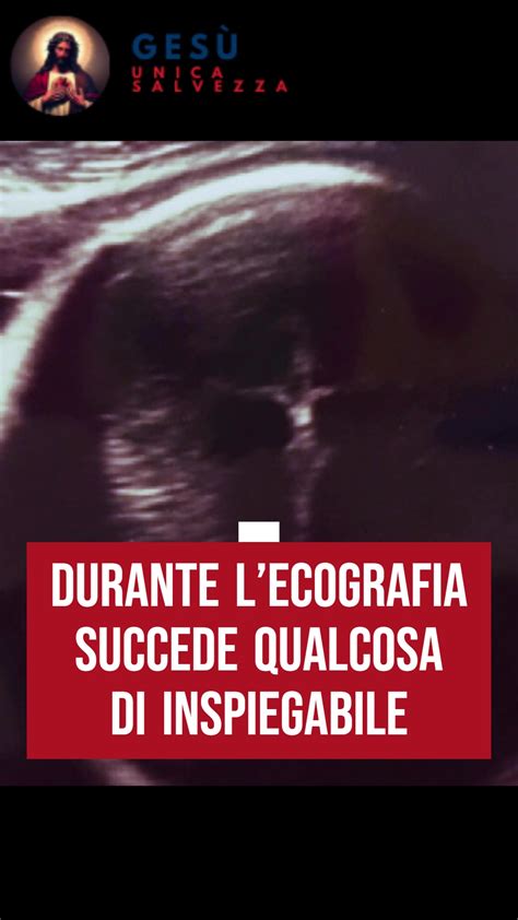 immagine di un'ecografia fetale che mostra il bambino