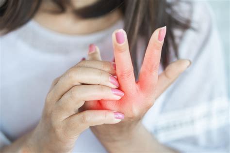 Zone di prurito intenso su mani e piedi nella colestasi gravidica