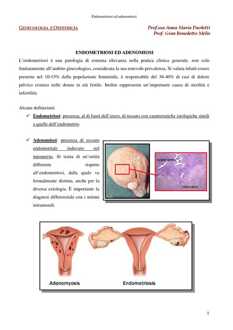 differenza tra adenomiosi ed endometriosi