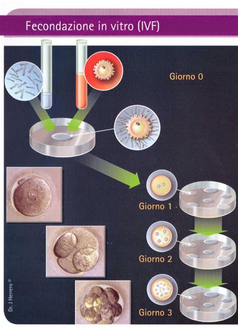 Microscopio e embrione in laboratorio di FIVET