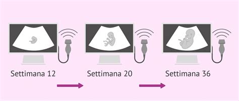 diagramma che mostra le fasi dello sviluppo fetale durante le ecografie