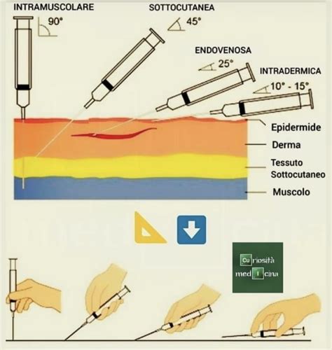 Diverse vie di somministrazione del progesterone