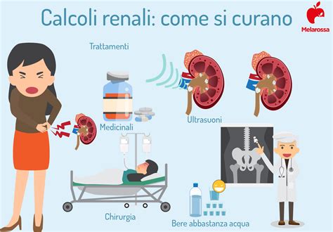 Trattamenti per i calcoli renali