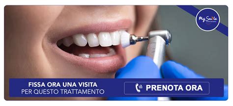 Dettaglio di un protocollo di igiene orale professionale spiegato a un genitore