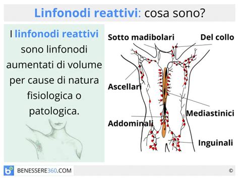 Tipi di Linfonodi Ingrossati