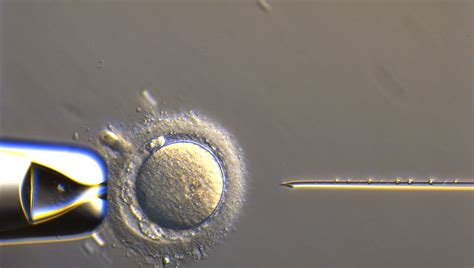 Fecondazione ICSI al microscopio