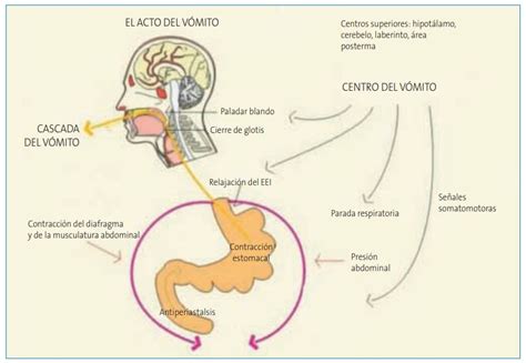 illustrazione medica che spiega il meccanismo del vomito nel bambino