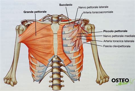 Illustrazione delle diverse morfologie del torace nel Pectus Excavatum