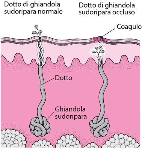 Tipi di Sudamina