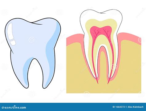 Illustrazione di un dente incluso