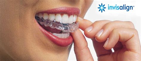 Allineatori trasparenti Invisalign First