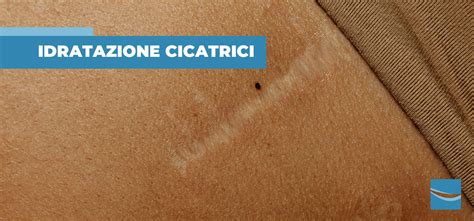 Cicatrici da morso d'amore su squalo femmina