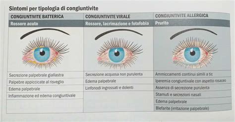 Tipi di congiuntivite e loro sintomi comuni