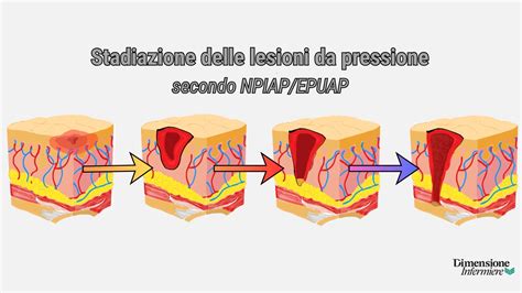 Diagramma che illustra le possibili lesioni al neonato durante il parto