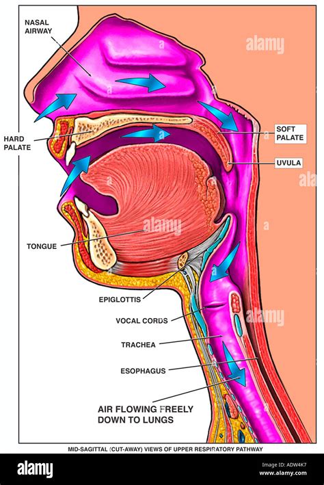 illustrazione anatomica delle vie aeree superiori nel bambino con evidenza di adenoidi e tonsille