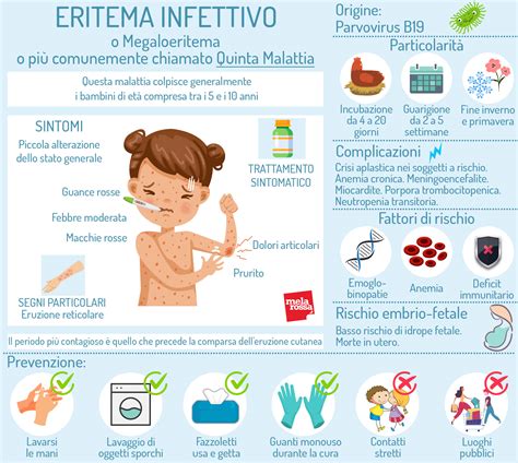 Illustrazione di un bambino con il caratteristico rossore sulle guance dovuto alla Quinta Malattia