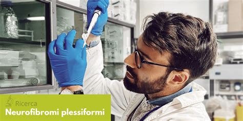 schema delle possibili localizzazioni dei neurofibromi e dei segni clinici associati