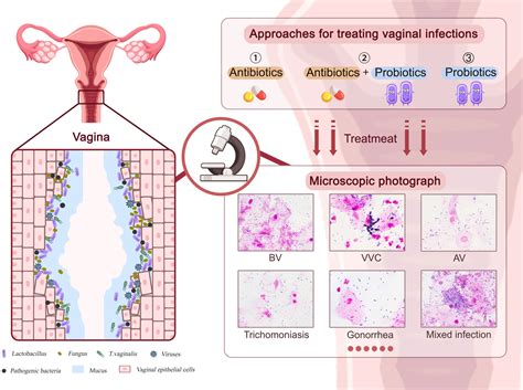 rappresentazione stilizzata del microbioma vaginale e del bilancio del pH