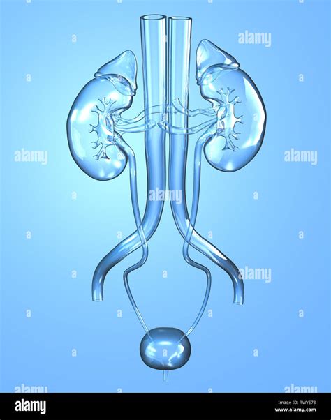 Illustrazione del sistema urinario con calcoli renali nell'uretere