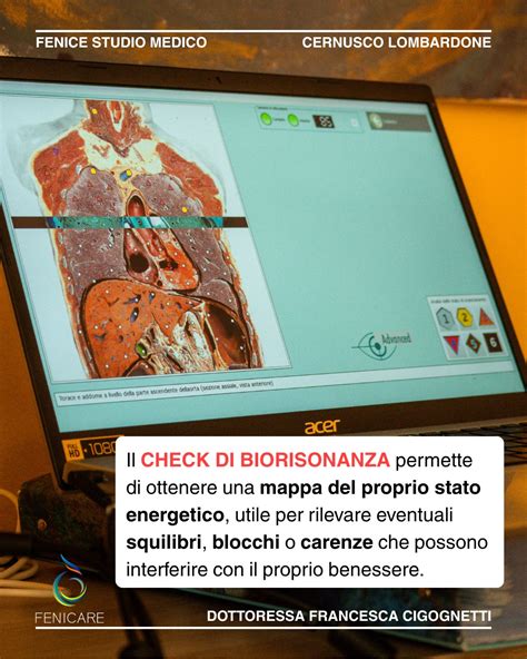 Rappresentazione di una gamma camera che rileva i radiofarmaci nel corpo