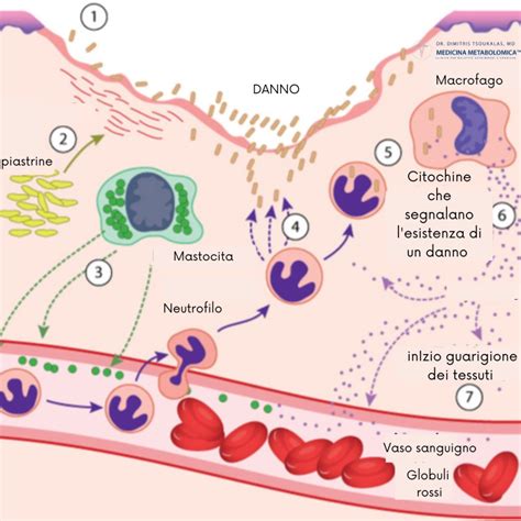 Schema infiammazione intestinale