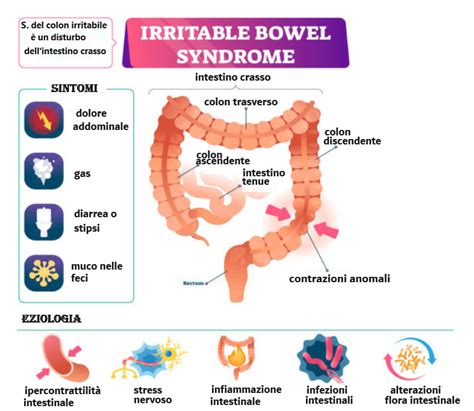 Immagine stilizzata del colon irritabile