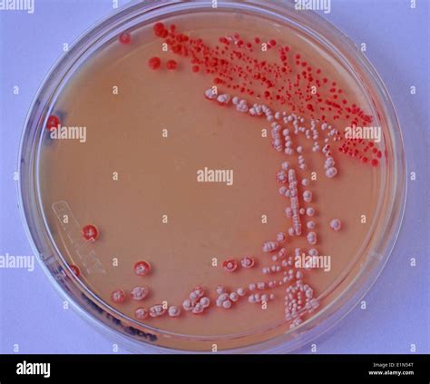 Microscopio con piastra di coltura embrionaria