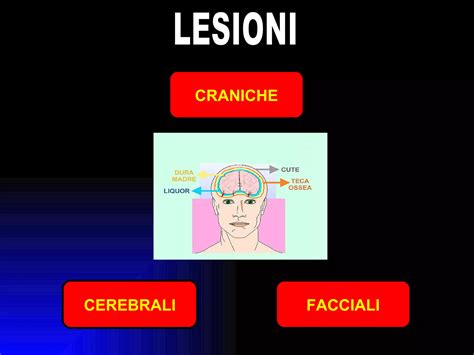 Diagramma delle lesioni craniche fetali