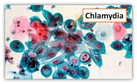 Microscopio elettronico di Chlamydia trachomatis
