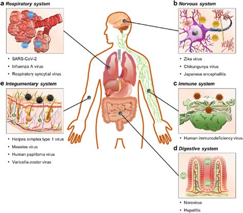 Infographic showing body parts affected by Rocefin-treatable infections