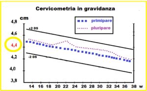 Cervicometria transvaginale: misurazione della lunghezza cervicale