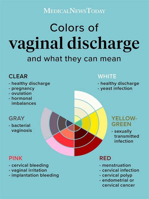 Vaginal discharge color chart