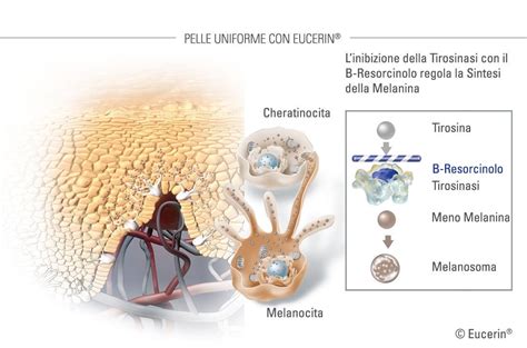 Schema illustrativo delle zone del corpo soggette a iperpigmentazione in gravidanza