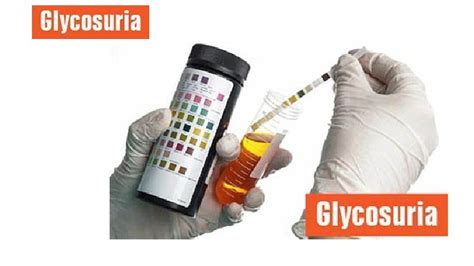 test diagnostici glucosuria