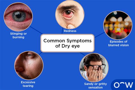 Dry eye causes and symptoms