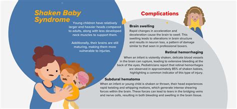 Infografica sulla Shaken Baby Syndrome: cause e prevenzione