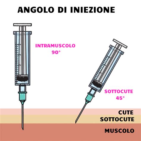 Illustrazione iniezione sottocutanea Ovitrelle