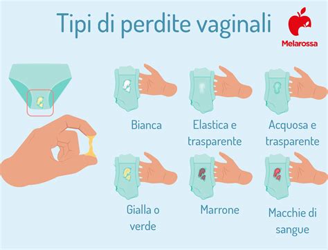 Infografica sui diversi tipi di perdite vaginali e i loro possibili significati