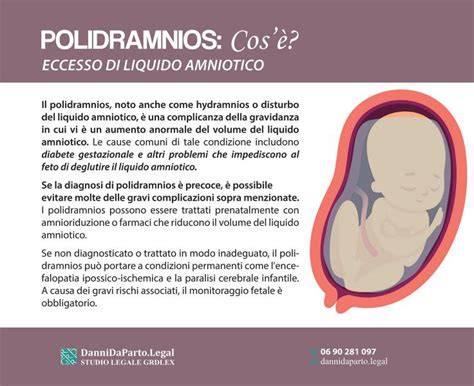 Grafico delle cause di polidramnios